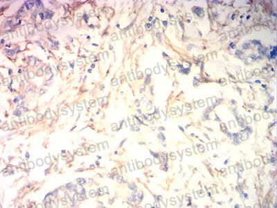 Валидация AntibodySystem RHB97303 (496)