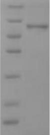 SDS-PAGE