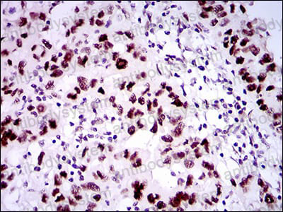 Валидация AntibodySystem RHG32402