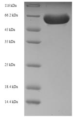 SDS-PAGE