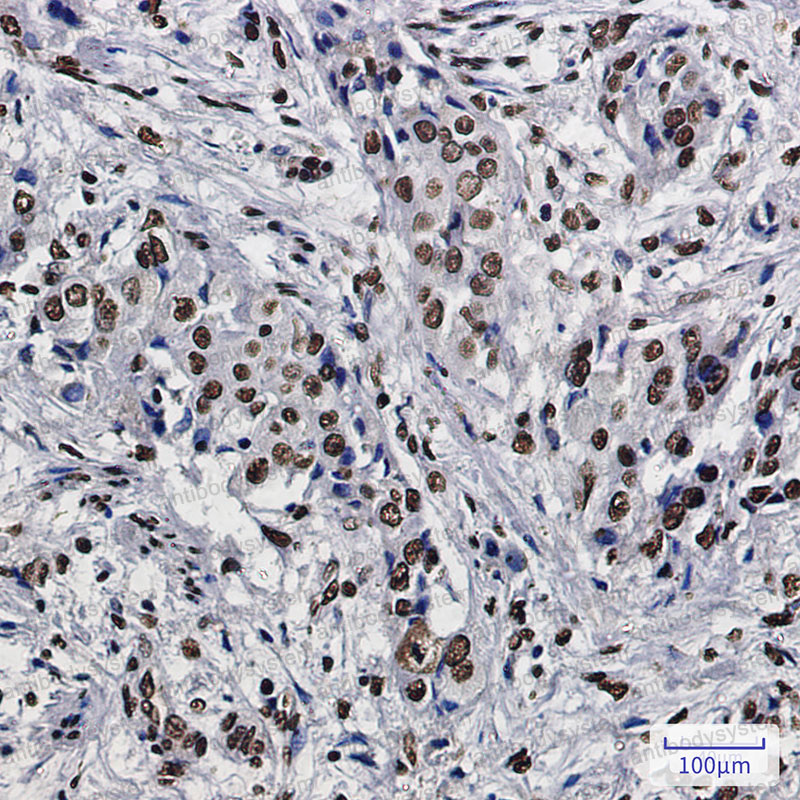 Валидация AntibodySystem RHF85501