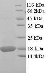 SDS-PAGE