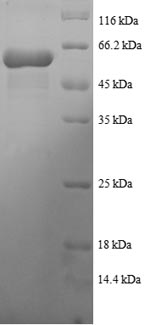 SDS-PAGE