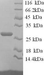 SDS-PAGE