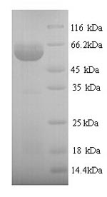 SDS-PAGE