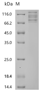 SDS-PAGE