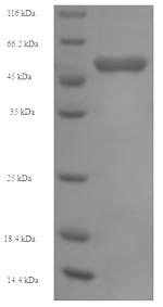 SDS-PAGE