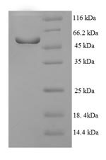 SDS-PAGE