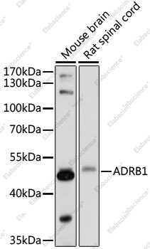 Вестерн-блоттинг, ADRB1, различные клеточные линии