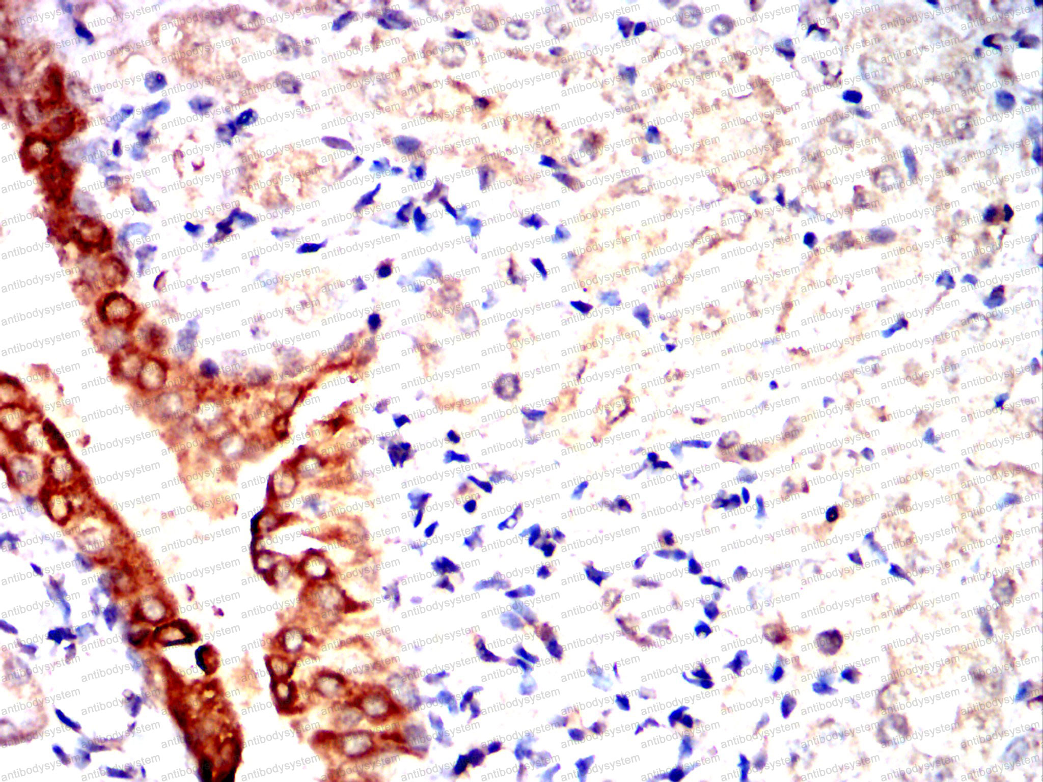 Валидация AntibodySystem RHF04003