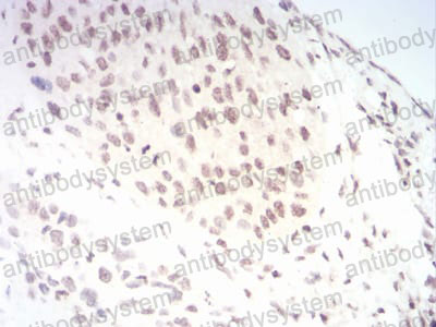 Валидация AntibodySystem RHA28702