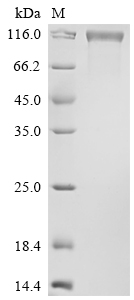 SDS-PAGE