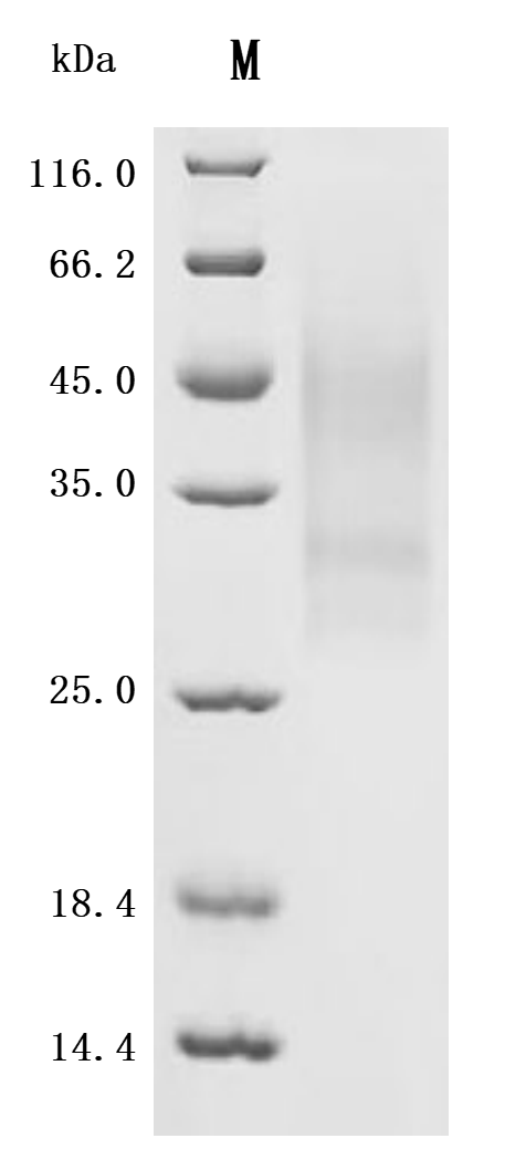 SDS-PAGE