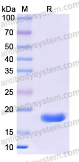 YHK63902, SDS-PAGE