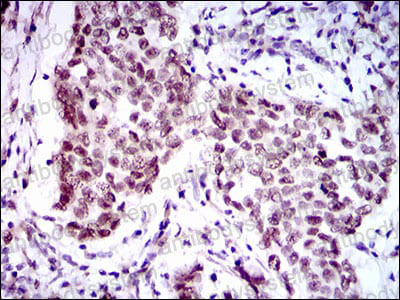 Валидация AntibodySystem RHJ56302 (3467)
