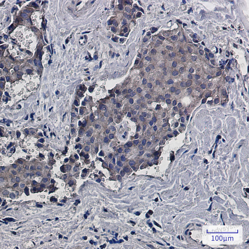 Валидация AntibodySystem RHF60301