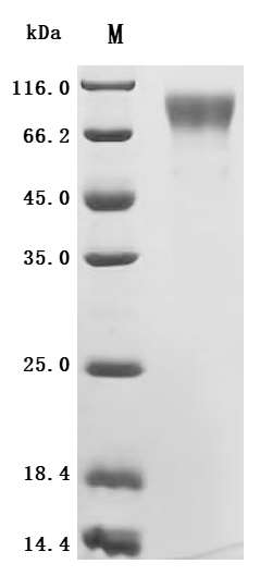 SDS-PAGE
