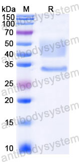 EHC34204, SDS-PAGE