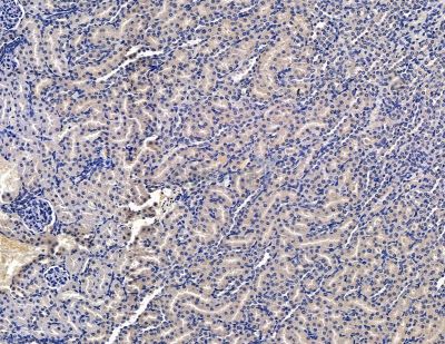 Валидация Affinity DF13902 - 9639