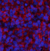 Иммунофлуоресценция, Phospho-Stat1 (Tyr701), ткань селезенки крысы