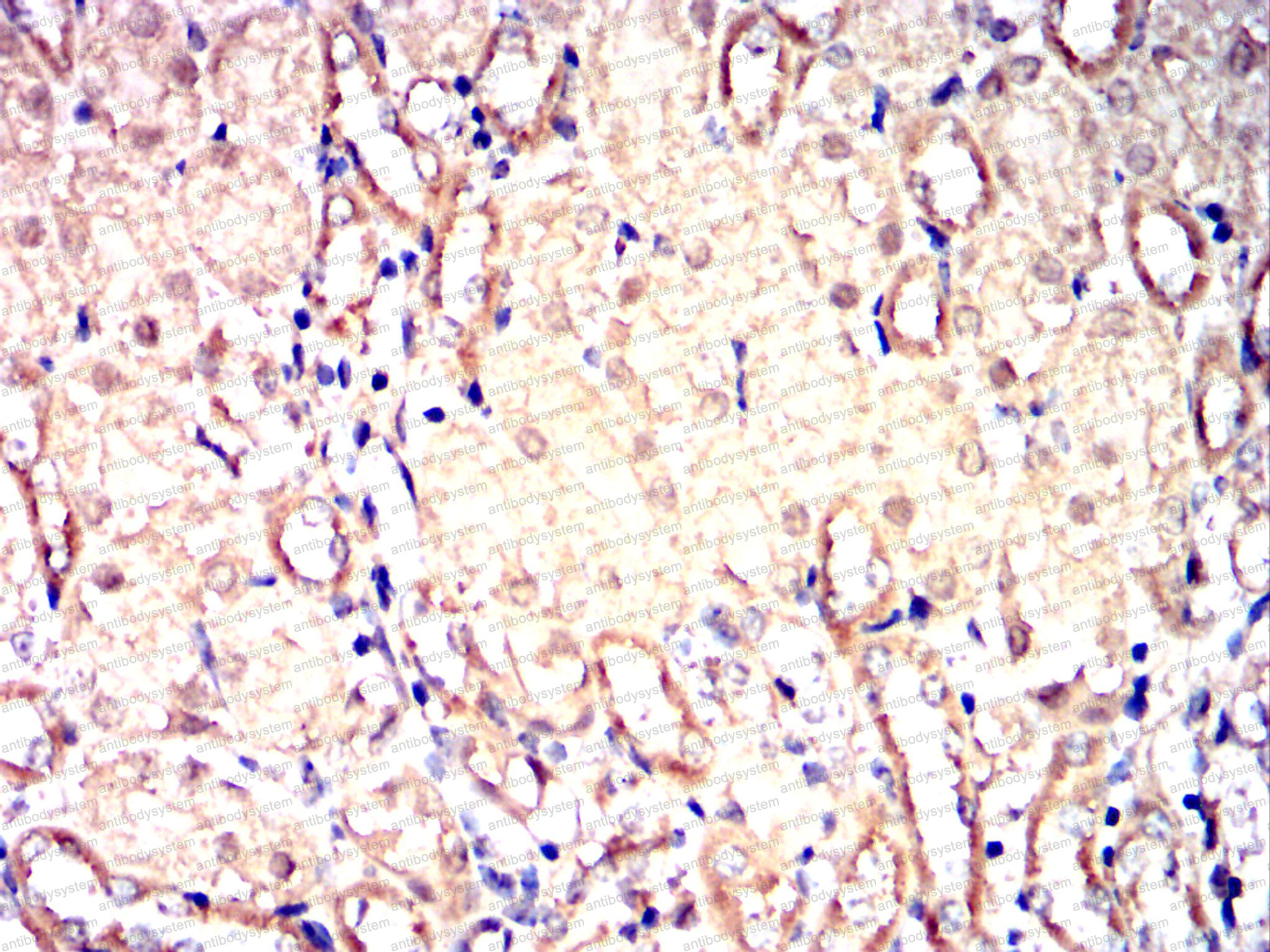 Валидация AntibodySystem RHK91801 (3745)