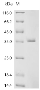 SDS-PAGE