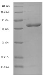 SDS-PAGE