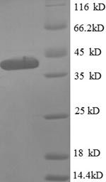 SDS-PAGE