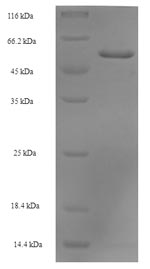SDS-PAGE