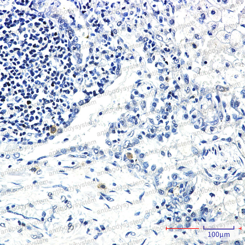 Валидация AntibodySystem RHG43501