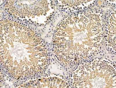 Валидация Affinity DF15125 - 11379