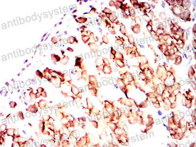 Валидация AntibodySystem RHD74903 (1795)