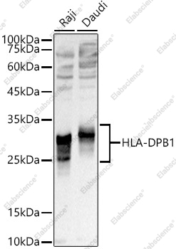 Вестерн-блоттинг, HLA-DPB1, различные клеточные линии