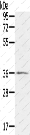 Вестерн-блоттинг, p53RFP, клетки TM4