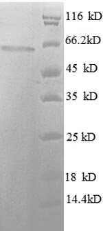SDS-PAGE