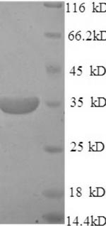 SDS-PAGE