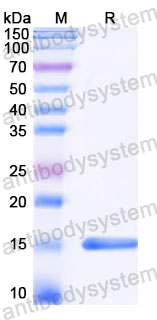 Валидация SDS-PAGE - AntibodySystem RZZ01818