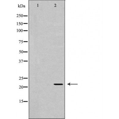 Валидация Affinity DF7236 - 18888