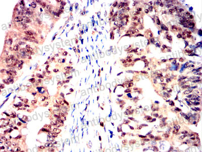 Валидация AntibodySystem RHB26402 (307)