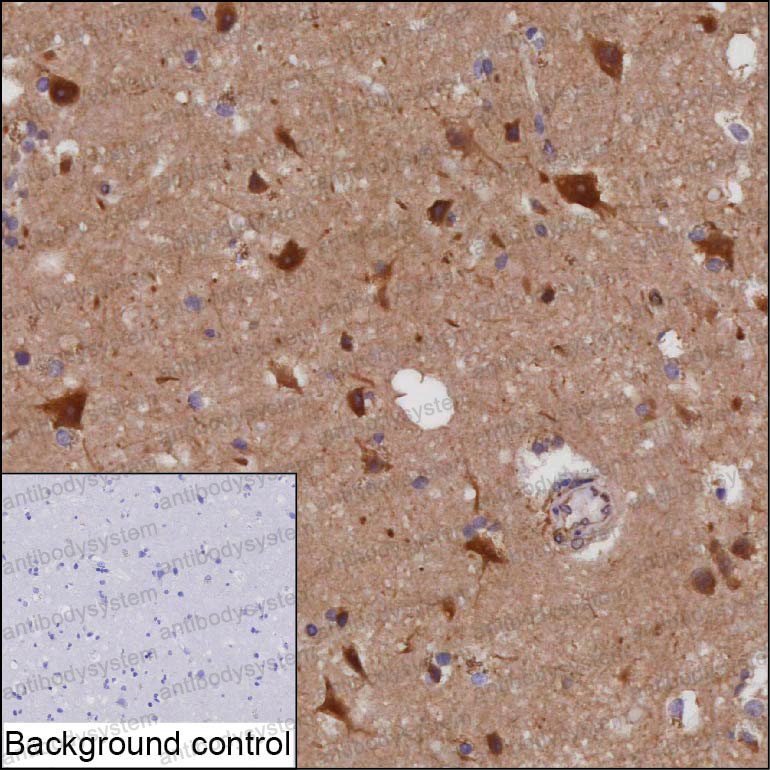 Валидация AntibodySystem RHF64501