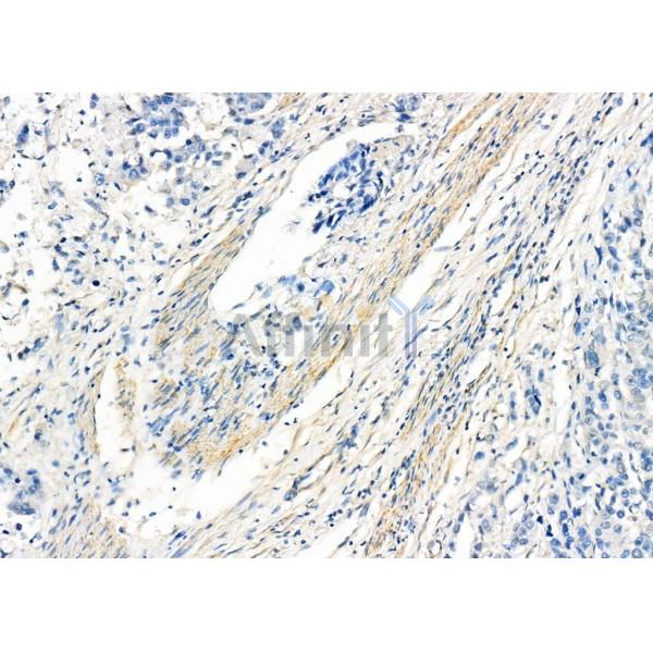 Валидация Affinity DF8344 - 20196