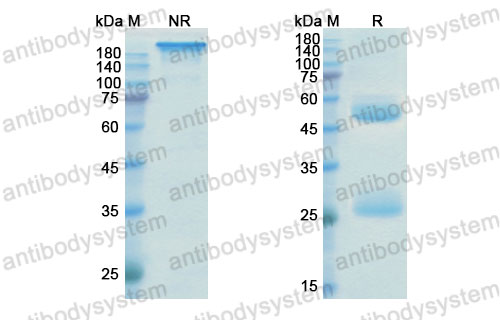 Валидация SDS-PAGE - AntibodySystem DHC13603