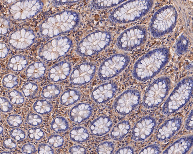 Валидация AssayVector ARM1225(592)