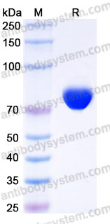 AHJ26402, SDS-PAGE