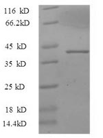 SDS-PAGE