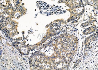 Валидация Affinity DF8970 - 21156