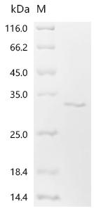 SDS-PAGE