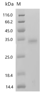 SDS-PAGE