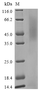 SDS-PAGE