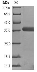 SDS-PAGE